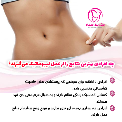 چه افرادی برای انجام عمل ماموپلاستی مناسب می باشند؟